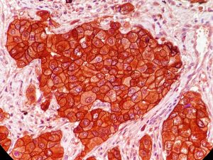 Immunohistochemistry Service